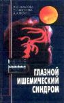 Глазной ишемический синдром  
Производитель: 