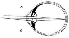 Схема аккомодации глаза